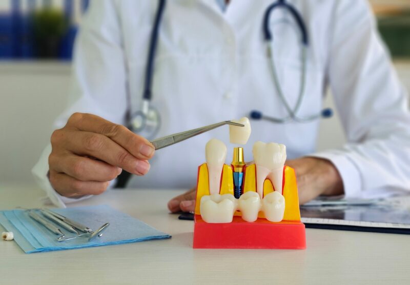 dental implants near me