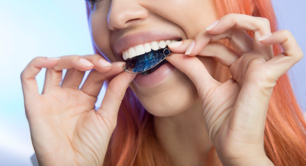 Woman placing a clear dental aligner over her teeth