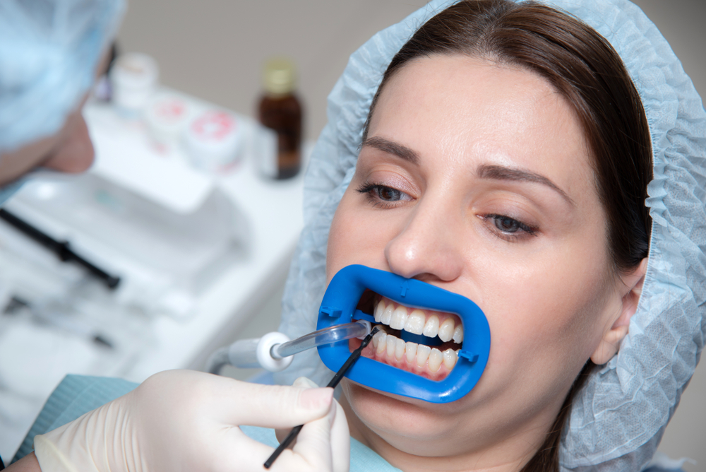 Patient receiving professional teeth whitening