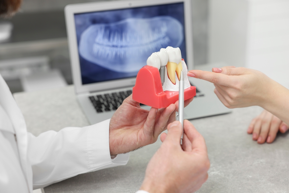 Dentist explaining a tooth model during a consultation
